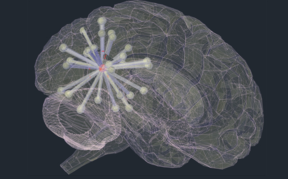 Advances in brain imaging settle debate over spread of key protein in Alzheimer’s