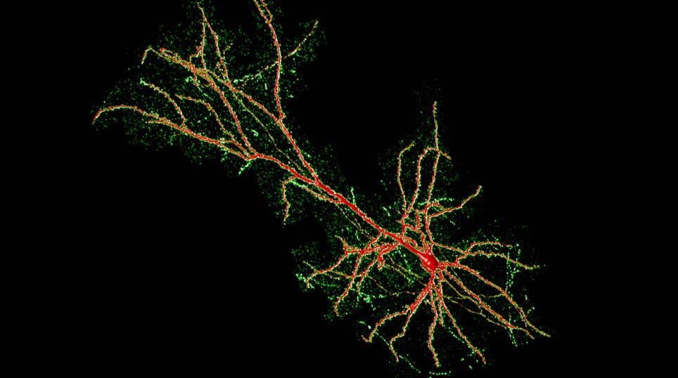 Neuron tracing