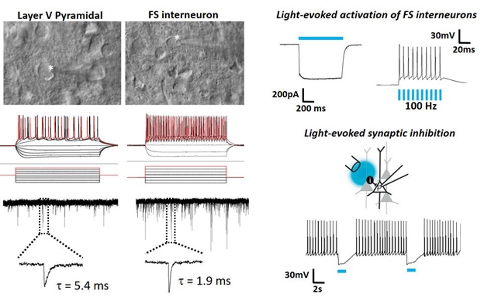 Recording in brain slices from old mice