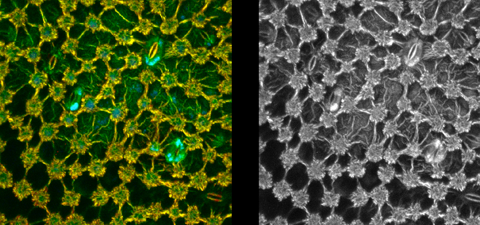 Images taken from the same autofluorescent plant leaf sample. Left: taken using FLIM. Right: taken using maximum intensity projection (MIP) imaging, The FLIM image shows areas that have the same brightness but very different lifetimes, which are not shown in the MIP image.