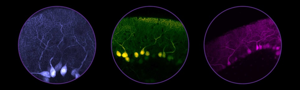 Multiphoton imaging and microscopy