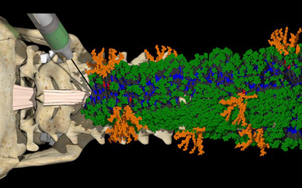 A new injectable therapy forms nanofibers with two different bioactive signals (green and orange) that communicate with cells to initiate repair of the injured spinal cord. Illustration by Mark Seniw.