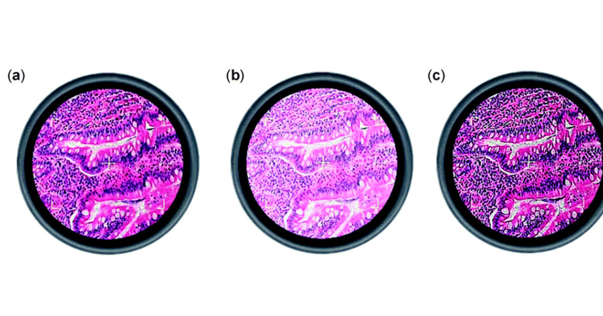 A 6 step guide to Koehler Illumination | Scientifica