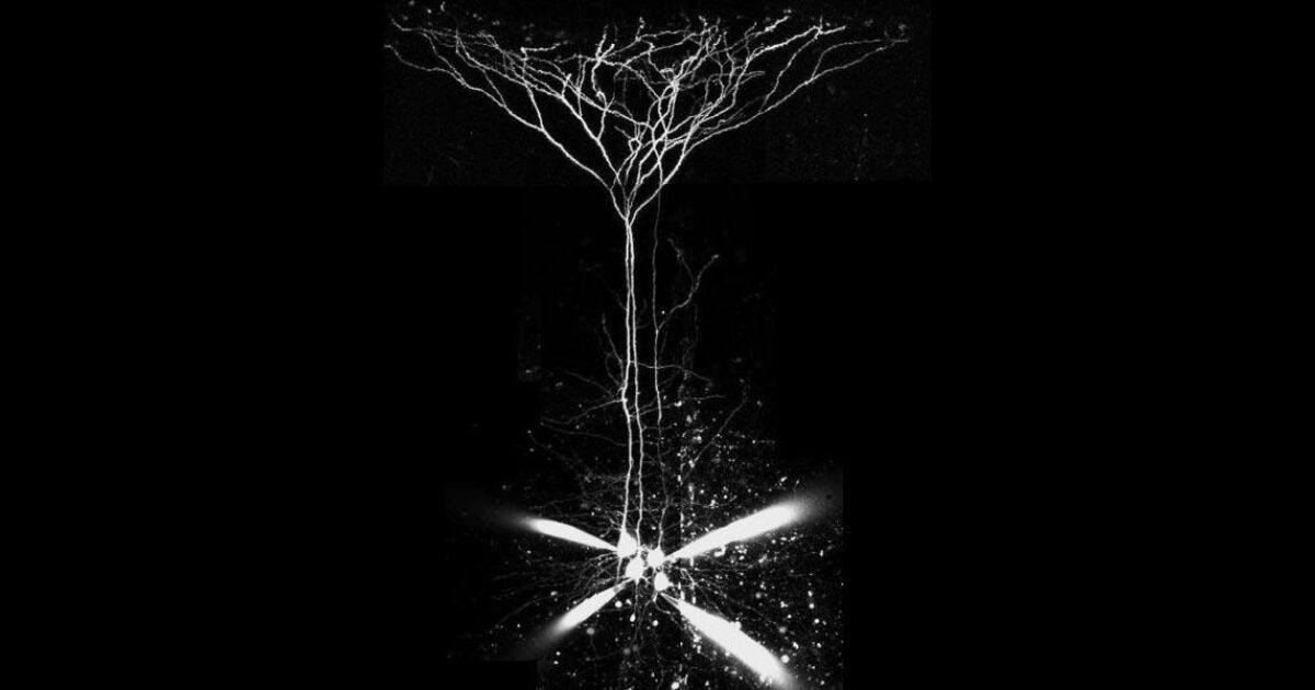 Using the PatchStar micromanipulator for a variety of… | Scientifica