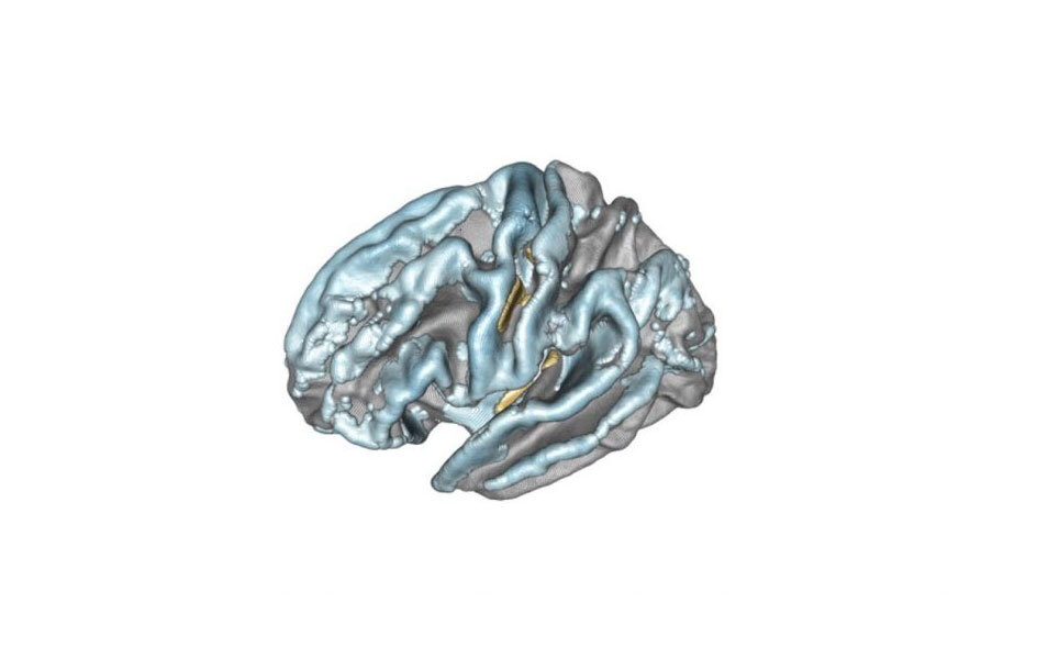 A New Statistical Method for Improved Brain Mapping. Image credit: Paris Brain Institute