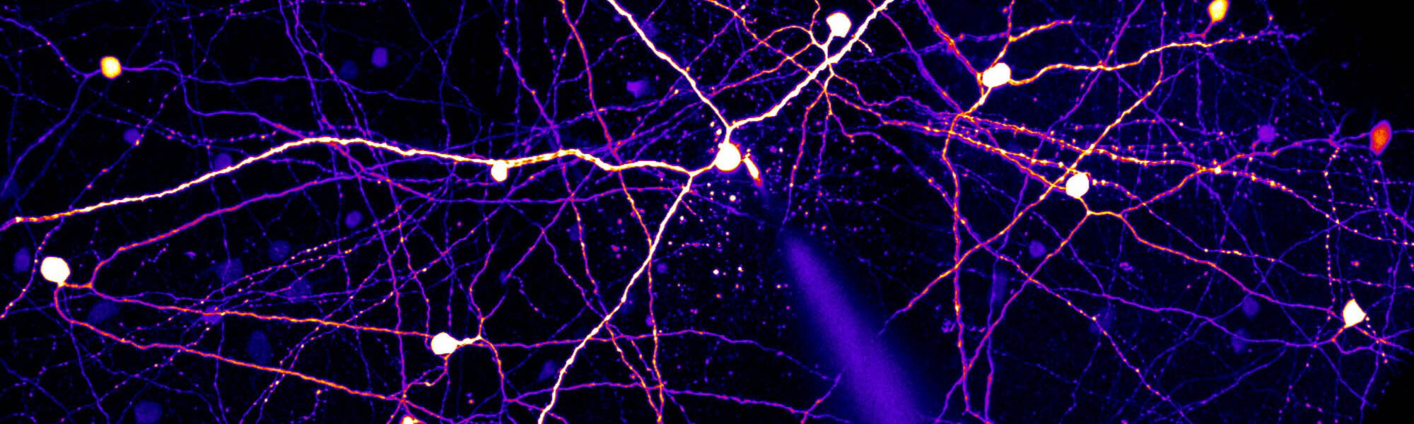 Tips for picking a good cell - slice electrophysiology