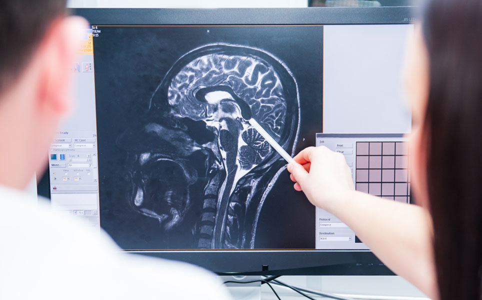 A replay of life: What happens in our brain when we die? Image credit: Frontiers/Okrasiuk/Shutterstock.com